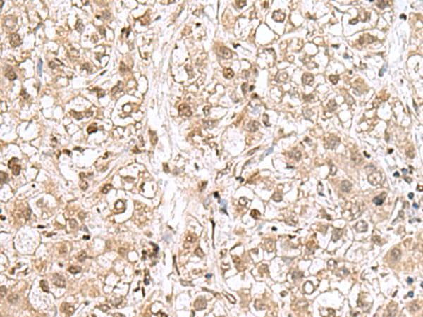 RPL35 / Ribosomal Protein L35 Antibody
