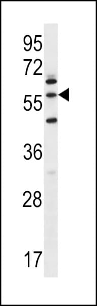 Polyclonal Rabbit anti-Human LETM2 Antibody (aa101-129, IHC, WB)