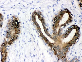 KRT19 / CK19 / Cytokeratin 19 Antibody