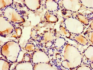 MED1 / TRAP220 Antibody