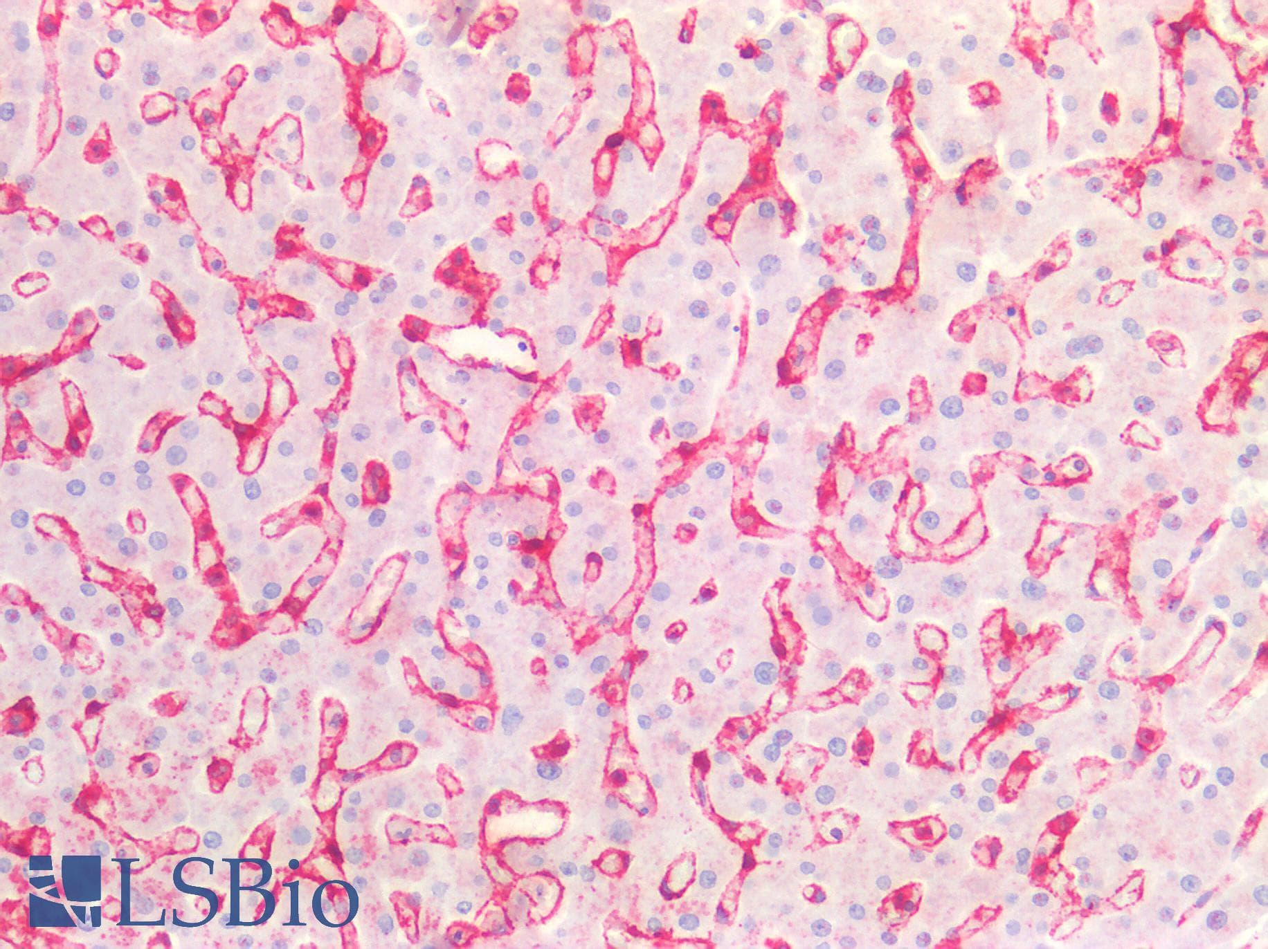 IHC-plus™ CAV1 / Caveolin 1 Antibody (aa129-178)