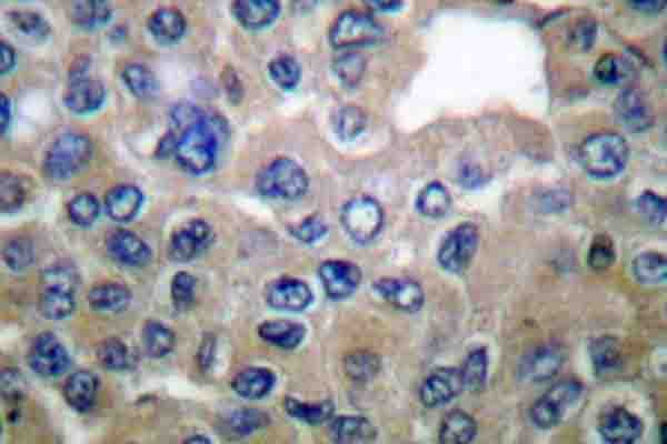 Polyclonal Rabbit anti-Human EEF2 / Elongation Factor 2 Antibody (phospho-Thr56, IHC, WB)