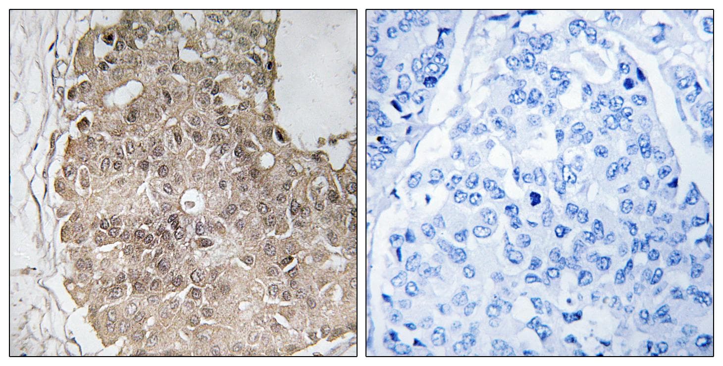 PARP4 / VPARP Antibody