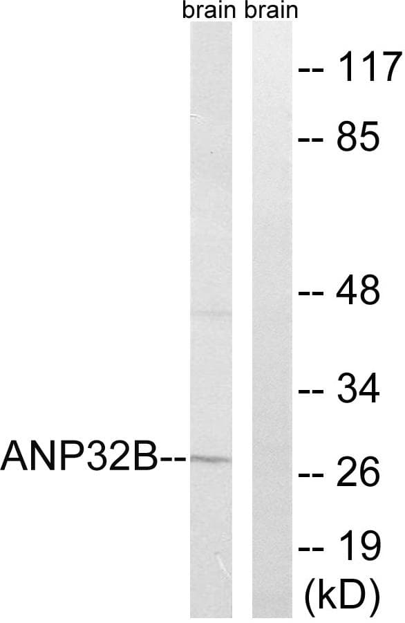 ANP32B Antibody