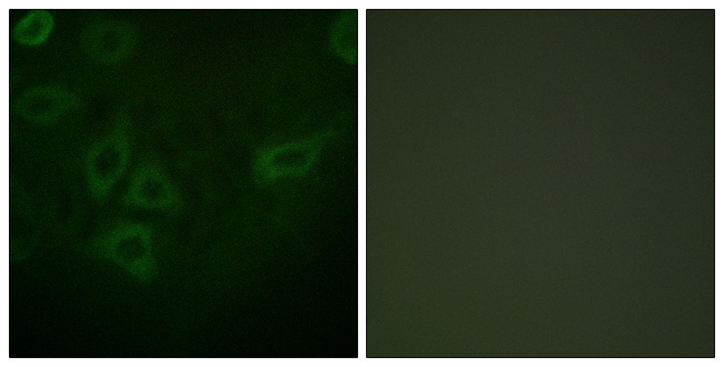 TK1 / TK / Thymidine Kinase Antibody (p13)
