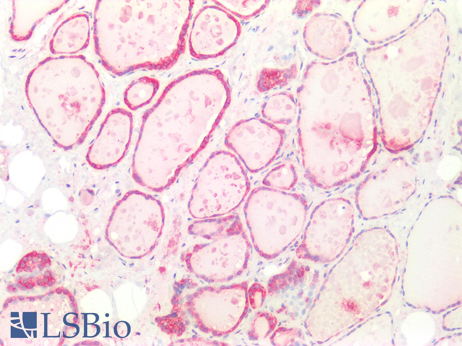 Polyclonal Rabbit anti-Mouse CD302 Antibody (aa21-225, IHC, WB)