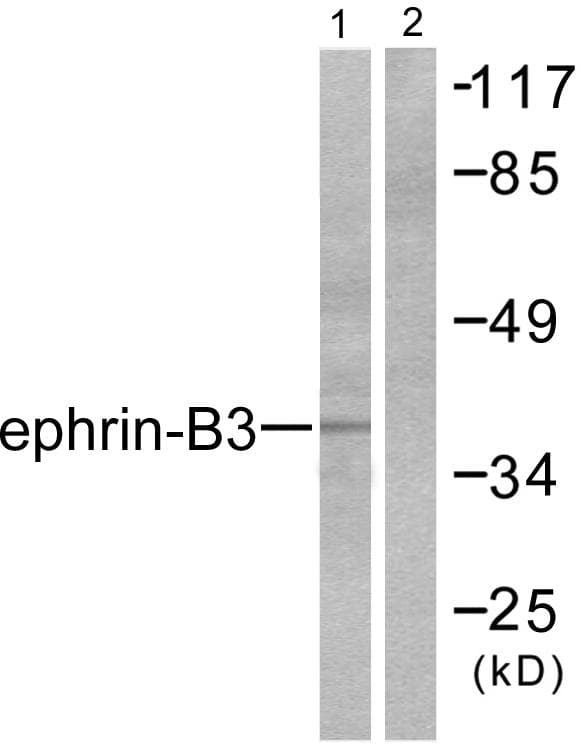 Polyclonal Rabbit anti-Human EFNB3 / Ephrin B3 Antibody (IHC, WB)