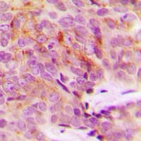 Polyclonal Rabbit anti-Human MRPS18A Antibody (Internal, IHC, WB)
