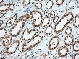 BDH2 Antibody (clone OTI3G10, Carrier-free)