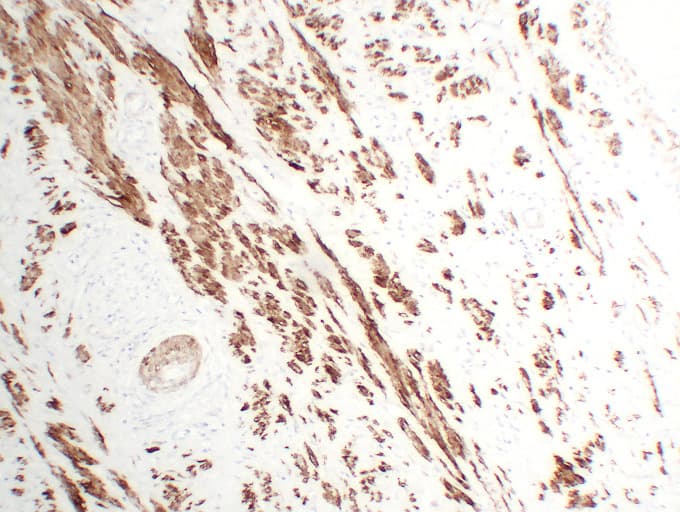 CNN1 / Calponin Antibody (clone ABT-CALP)