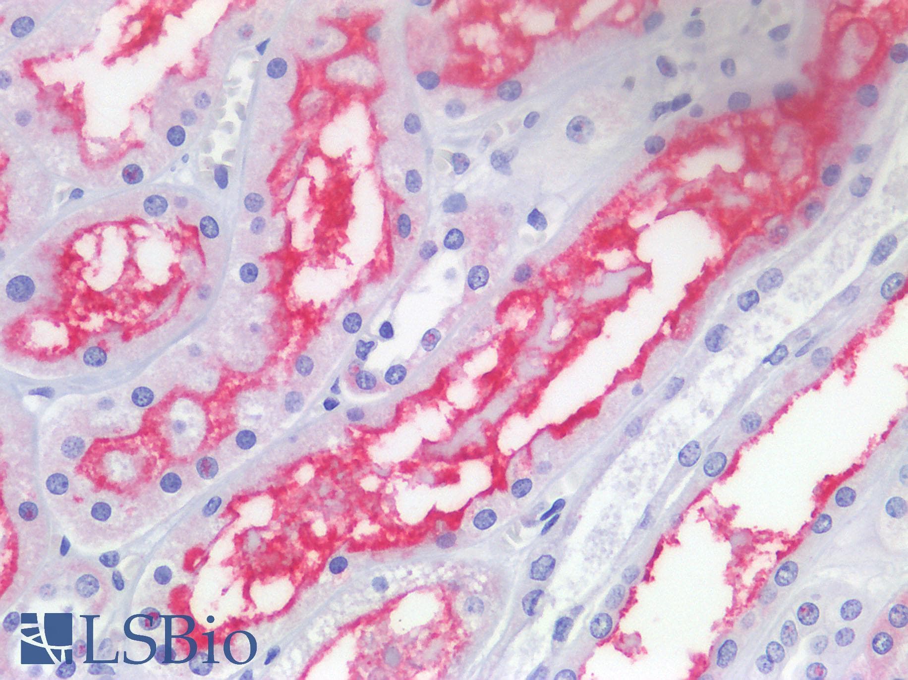 IHC-plus™ ACE2 / ACE-2 Antibody (aa140-172)