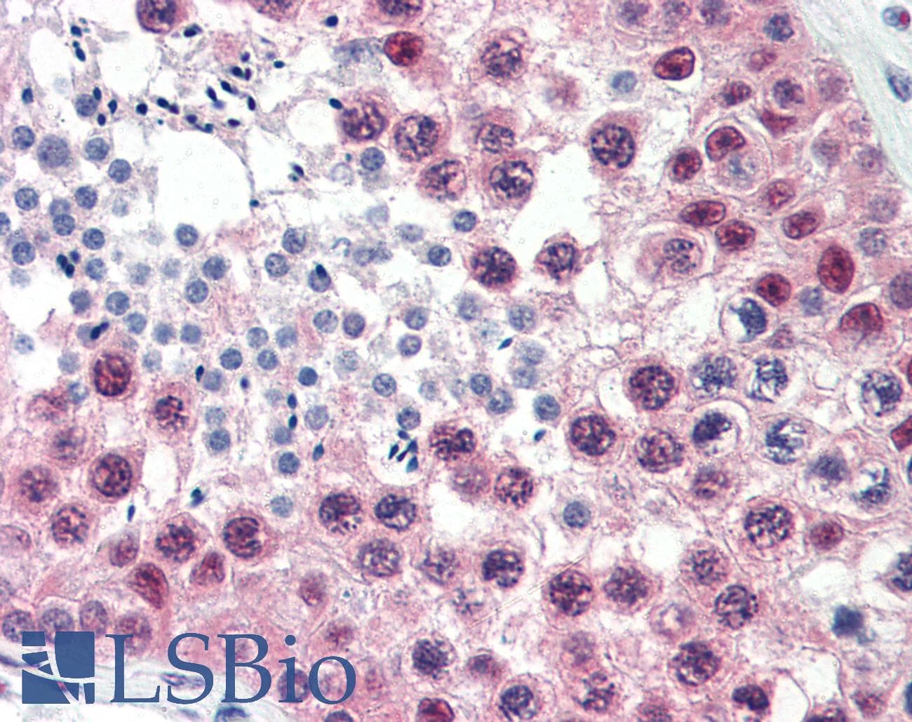 IHC-plus™ CUL1 / Cullin 1 Antibody (C-Terminus)