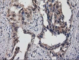 DSTN / Destrin Antibody (clone OTI2F7)