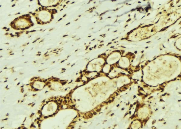 TSN / Translin Antibody