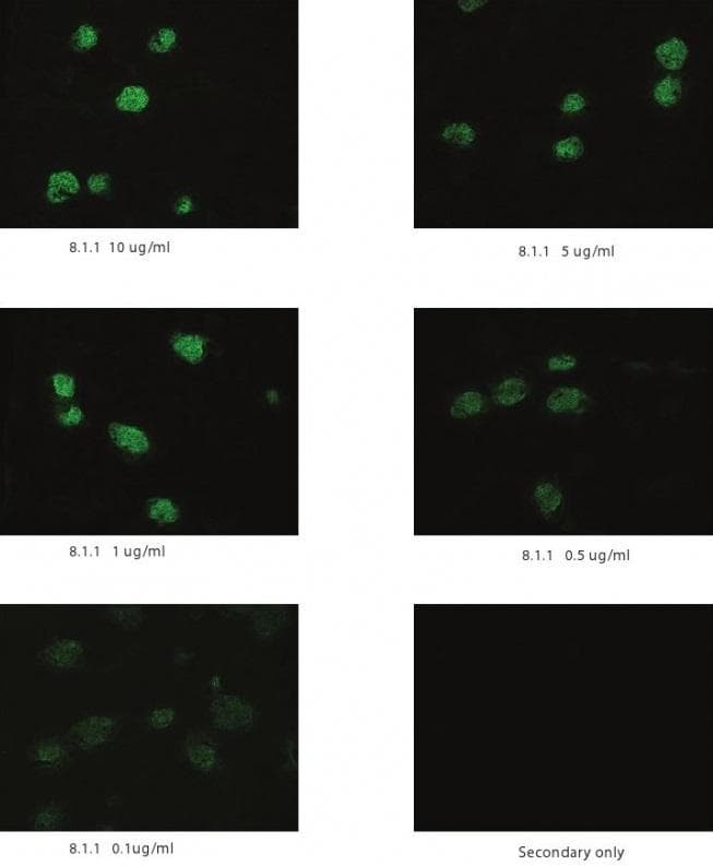 PDPN / Podoplanin Antibody (clone 8.1.1)