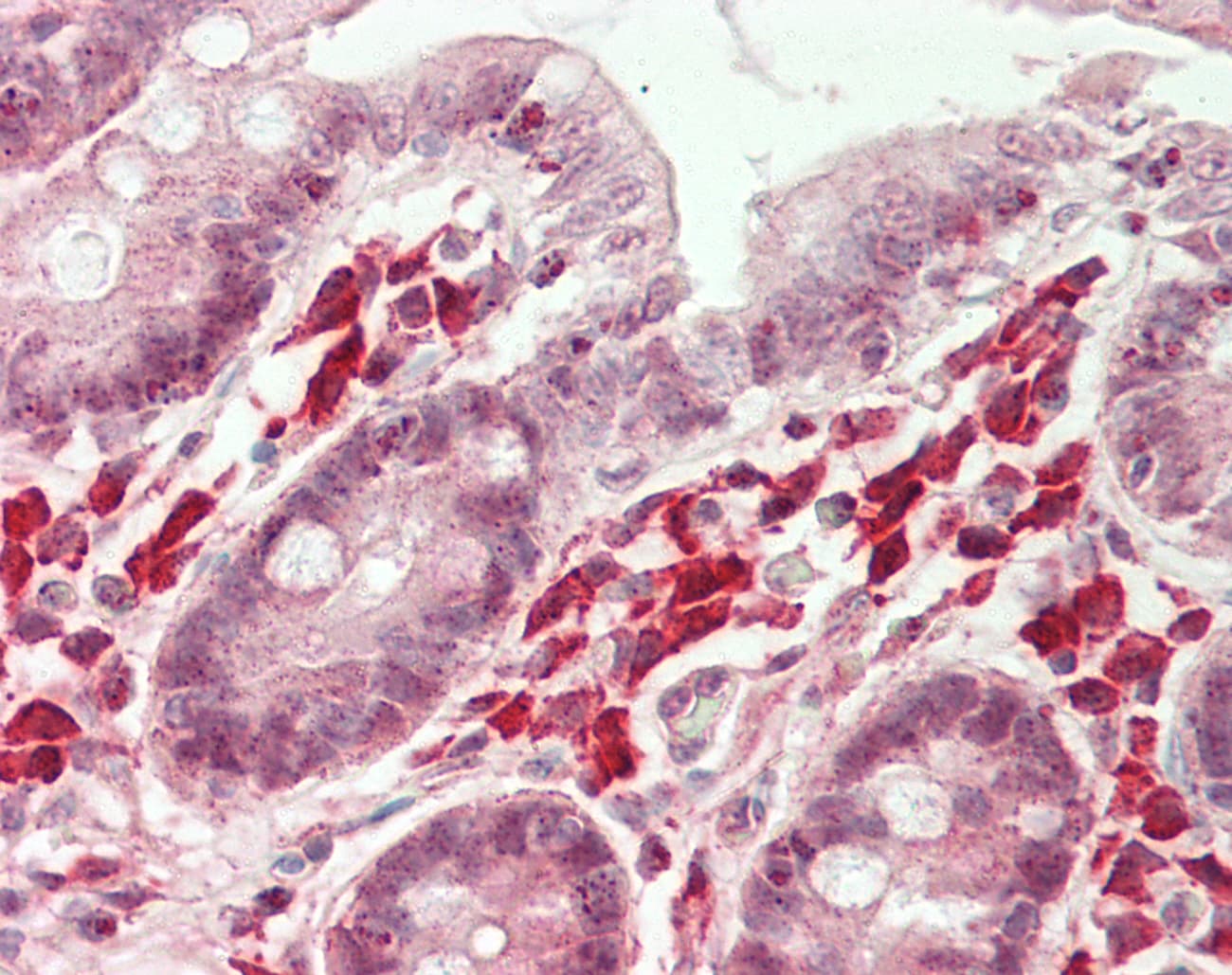 IHC-plus™ Polyclonal Rabbit anti-Human NFATC4 / NFAT3 Antibody (aa300-350, IHC, WB)