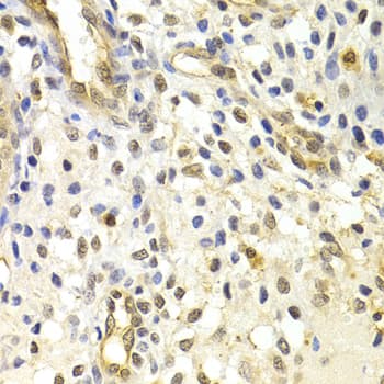 RAD50 Antibody