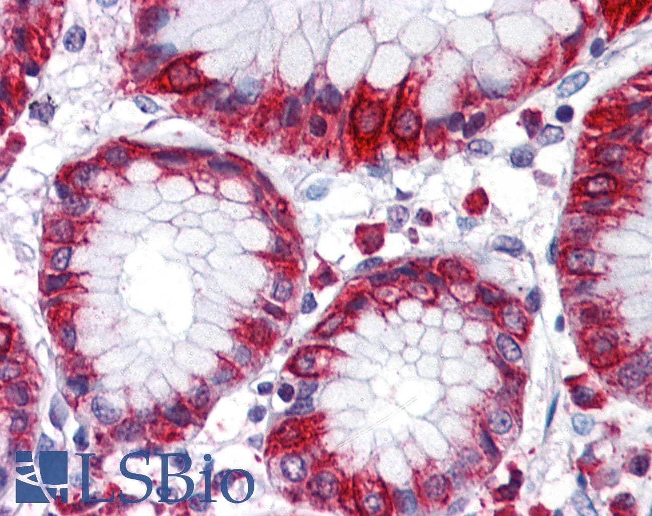 IHC-plus™ Polyclonal Rabbit anti-Human FKSG89 / MBOAT4 Antibody (Internal, IHC)