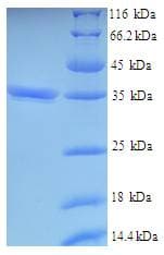 Human VSTM2L Protein (Recombinant His-SUMO)