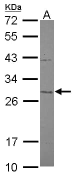 IF3mt / MTIF3 Antibody