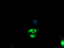 GOLM1 / GP73 / GOLPH2 Antibody (clone 6C9, Carrier-free)