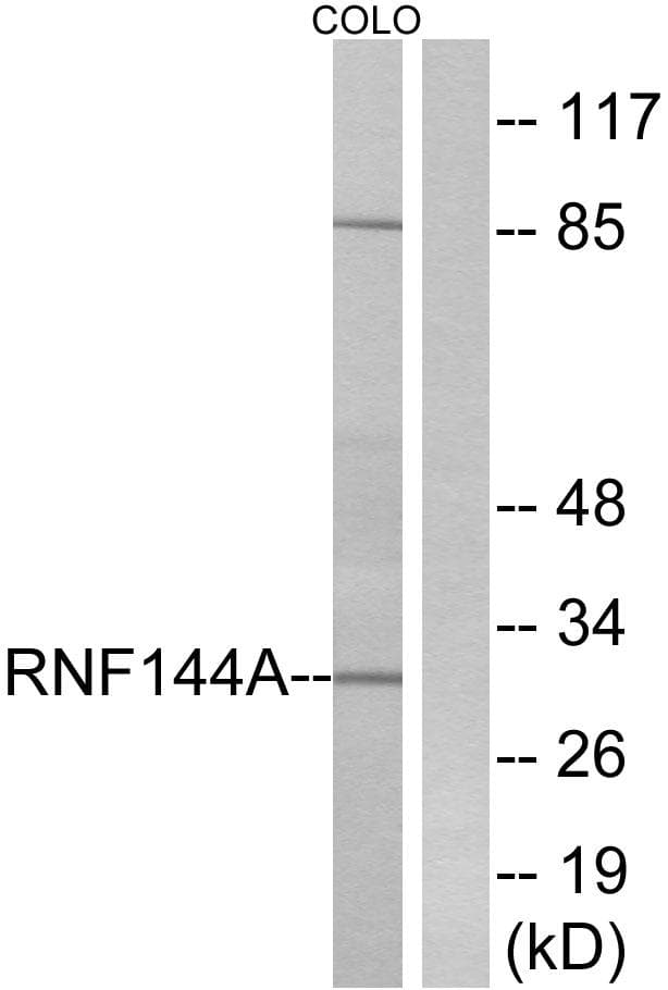 RNF144A / RNF144 Antibody