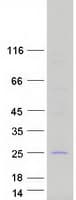 Human C1QTNF3 / CTRP3 Protein (Recombinant Myc-DDK (Flag))