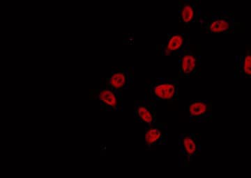 Polyclonal Rabbit anti-Human EXO1 Antibody (IF, WB)