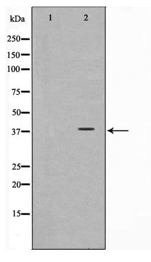 DNAM-1 / CD226 Antibody