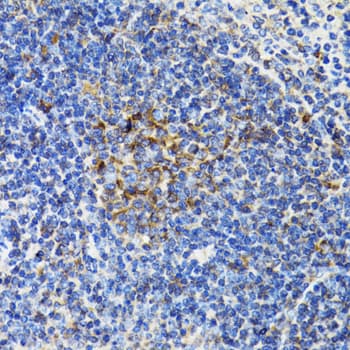Polyclonal Rabbit anti-Human BAP29 / BCAP29 Antibody (IHC, WB)