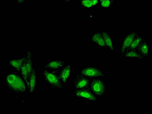 Polyclonal Rabbit anti-Human ABCC4 / MRP4 Antibody (IF)
