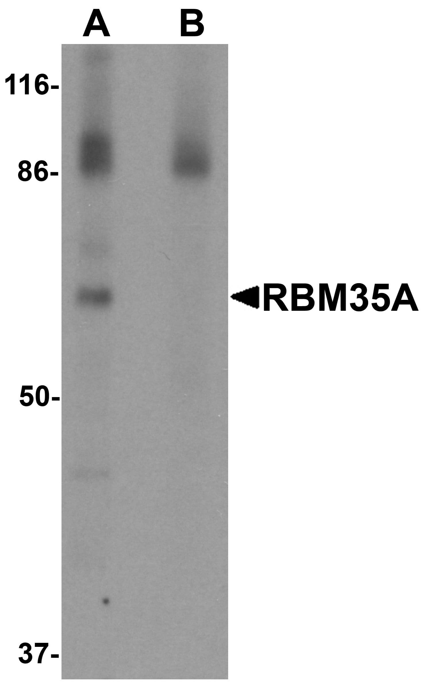 IHC-plus™ ESRP1 / RBM35A Antibody