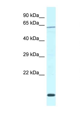 WDR23 / DCAF11 Antibody (aa335-384)