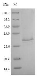 Toxocara canis TES26/26 kDa Secreted Antigen Protein (Recombinant 6His, N-terminus)