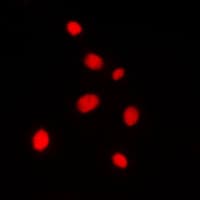 AKAP8 / AKAP95 Antibody (Internal)
