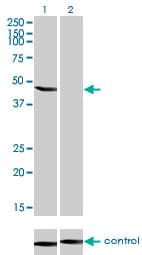 IHC-plus™ ENO3 / Enolase 3 Antibody (clone 5D1)