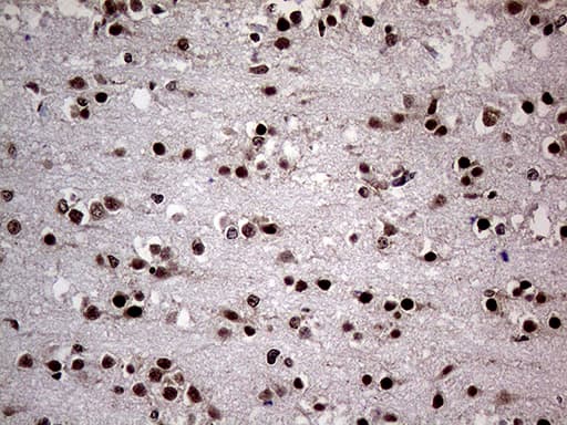 NPAS1 Antibody (aa319-522, clone OTI4C10, Carrier-free)