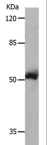 Polyclonal Rabbit anti-Human MMP8 Antibody (IHC, WB)