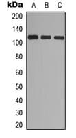 EPHA7 / EPH Receptor A7 Antibody (phospho-Tyr608)