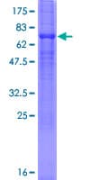 Human SLC23A2 / SVCT2 Protein (Recombinant GST)