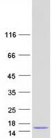 Human CTNNBIP1 / ICAT Protein (Recombinant Myc-DDK (Flag))