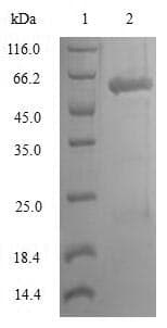 Rat Lumican Protein (Recombinant 6His, N-terminus)