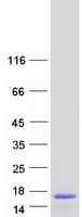 Human CDKN2B / p15 INK4b Protein (Recombinant Myc-DDK (Flag))
