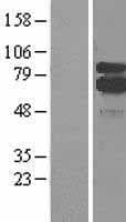 ALOX5 / 5-LOX Protein (Over-Expression Lysate Myc-DDK (Flag))