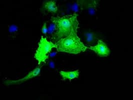 MOBKL2B / MOB3B Antibody (clone OTI3A8)