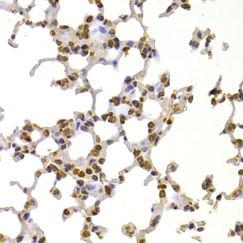 S100A4 / FSP1 Antibody