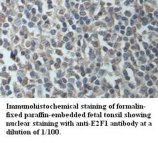 Polyclonal Rabbit anti-Human E2F1 Antibody (IHC, WB)