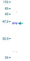 Human UBCH10 / UBE2C Protein (Recombinant GST)