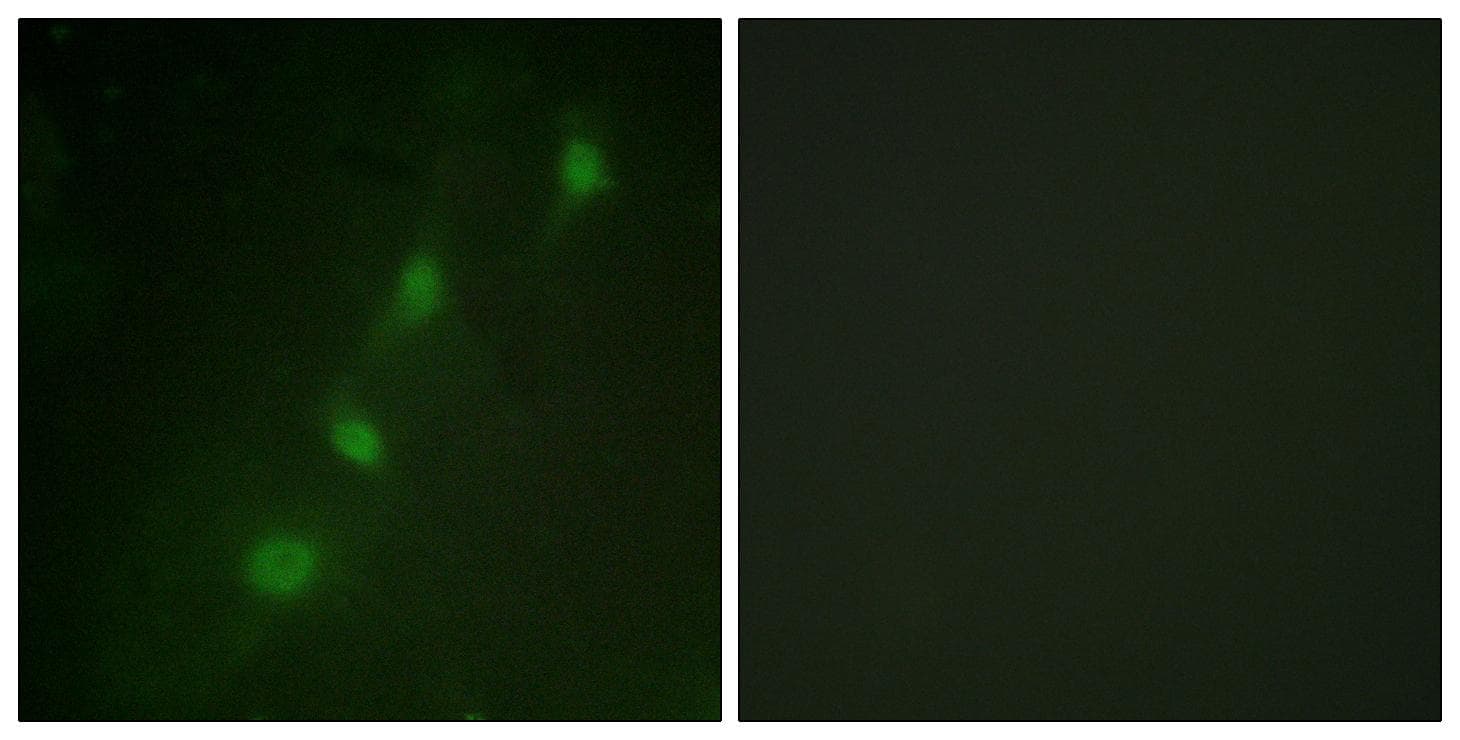 Polyclonal Rabbit anti-Human SGK1 / SGK Antibody (p78, IHC, IF, WB)