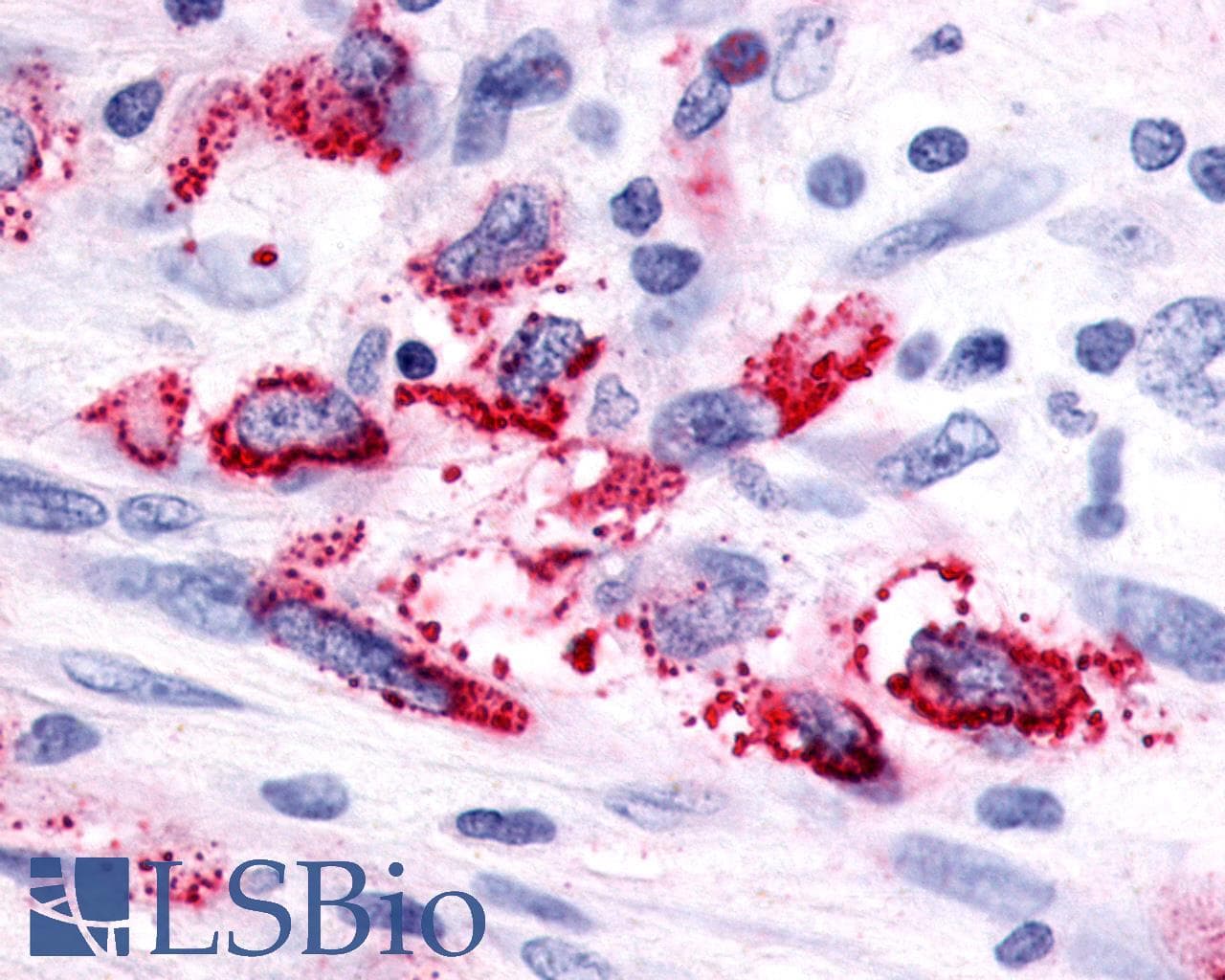 PathPlus™ Polyclonal Rabbit anti-Human ADGRF5 / GPR116 Antibody (Cytoplasmic Domain, IHC)